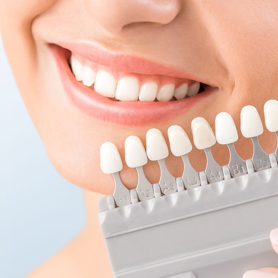 science behind teeth whitening thumb